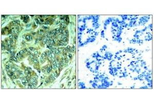 Immunohistochemistry (IHC) image for anti-Docking Protein 1, 62kDa (Downstream of tyrosine Kinase 1) (DOK1) (pTyr398) antibody (ABIN7138998)