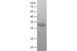 Western Blotting (WB) image for S100 Calcium Binding Protein A12 (S100A12) (AA 2-92) protein (His-IF2DI Tag) (ABIN7283660) (S100A12 Protein (AA 2-92) (His-IF2DI Tag))