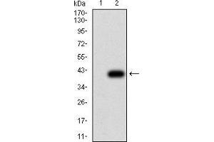 Western blot analysis using THBS1 mAb against HEK293 (1) and THBS1 (AA: 750-850)-hIgGFc transfected HEK293 (2) cell lysate. (Thrombospondin 1 antibody  (AA 750-850))
