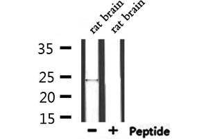 Western blot analysis of extracts from rat brain, using ZNRF1 Antibody. (ZNRF1 antibody  (Internal Region))