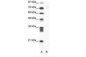 Image no. 1 for anti-Aspartate beta-Hydroxylase (ASPH) (AA 312-361) antibody (ABIN202902) (Aspartate beta Hydroxylase antibody  (AA 312-361))