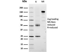 SDS-PAGE Analysis Purified TYRP1-Monospecific Mouse Monoclonal Antibody (TYRP1/3280). (Tyrosinase-Related Protein 1 antibody  (AA 257-377))