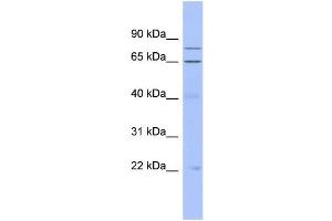 WB Suggested Anti-ZNF431 Antibody Titration:  0. (ZNF431 antibody  (Middle Region))