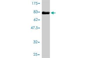 Western Blot detection against Immunogen (72. (IL11RA antibody  (AA 1-422))
