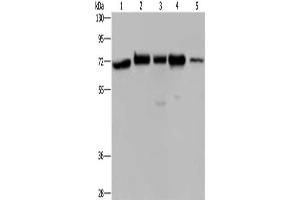 Gel: 8 % SDS-PAGE, Lysate: 40 μg, Lane 1-5: A172 cells, Hela cells, 293T cells, K562 cells, human testis tissue, Primary antibody: ABIN7128290(AGFG1 Antibody) at dilution 1/727, Secondary antibody: Goat anti rabbit IgG at 1/8000 dilution, Exposure time: 40 seconds (AGFG1 antibody)
