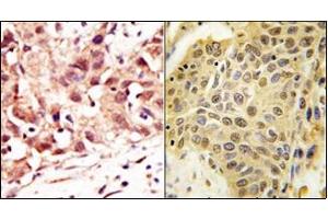 Image no. 2 for anti-SUMO1/sentrin Specific Peptidase 5 (SENP5) (C-Term) antibody (ABIN356757) (SENP5 antibody  (C-Term))