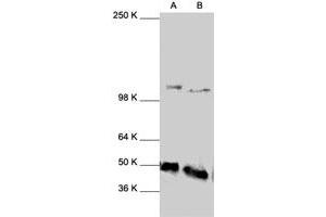 Western Blot analysis of NFKB1 polyclonal antibody  expression in HeLa (A) and HL-60 (B) whole cell lysates. (NFKB1 antibody  (C-Term))