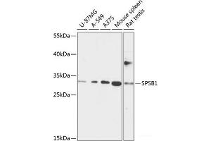 Western blot analysis of extracts of various cell lines using SPSB1 Polyclonal Antibody at dilution of 1:1000. (SPSB1 antibody)