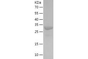 Western Blotting (WB) image for C-Type Lectin Domain Family 11, Member A (CLEC11A) (AA 22-323) protein (His tag) (ABIN7289442) (CLEC11A Protein (AA 22-323) (His tag))