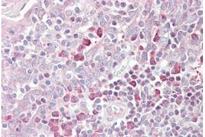 Anti-MARCH6 antibody IHC staining of human tonsil. (MARCH6 antibody  (AA 886-898))