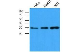 The cell lysates (40 ug) were resolved by SDS-PAGE, transferred to PVDF membrane and probed with anti-human CBR1 antibody (1:1,000). (CBR1 antibody  (AA 1-277))