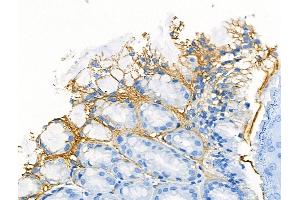 ABIN6260865 and ABIN6266509 at 1/100 staining Mouse stomach tissue by IHC-P.