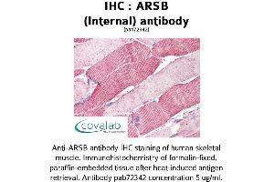 Image no. 1 for anti-Arylsulfatase B (ARSB) (Internal Region) antibody (ABIN1731968) (Arylsulfatase B antibody  (Internal Region))