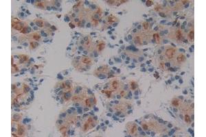 DAB staining on IHC-P; Samples: Human Stomach Tissue (SIRPB1 antibody  (AA 127-356))