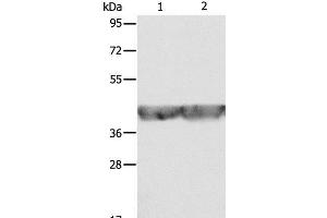 Western Blot analysis of A549 and hela cell using ALDOA Polyclonal Antibody at dilution of 1:500 (ALDOA antibody)