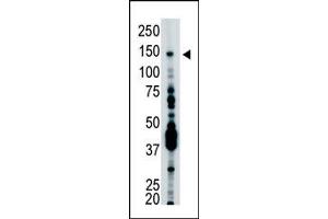 Image no. 1 for anti-Ubiquitin Specific Peptidase 7 (Herpes Virus-Associated) (USP7) (C-Term) antibody (ABIN357533) (USP7 antibody  (C-Term))