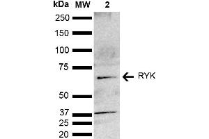 Western blot analysis of Mouse brain lysate showing detection of ~67. (RYK antibody  (AA 150-250) (Biotin))