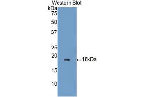 Western blot analysis of the recombinant protein. (HPSE antibody  (AA 400-543))