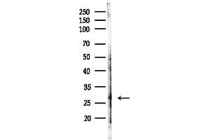anti-Protease, serine, 3 (PRSS3) (N-Term) antibody