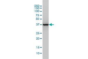 ALDOA monoclonal antibody (M01), clone 3C12-6D11 Western Blot analysis of ALDOA expression in A-431 . (ALDOA antibody  (AA 1-364))