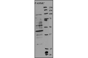 Western blot analysis of anti-RFC5 Antibody (Center ) (ABIN389314 and ABIN2839435) in rat SMC cell line lysates (35 μg/lane). (RFC5 antibody  (AA 170-200))