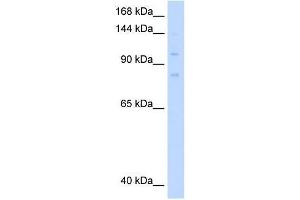 MCM8 antibody used at 0. (MCM8 antibody  (C-Term))