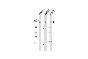Western Blot at 1:2000 dilution Lane 1: A549 whole cell lysate Lane 2: Jurkat whole cell lysate Lane 3: K562 whole cell lysate Lysates/proteins at 20 ug per lane.