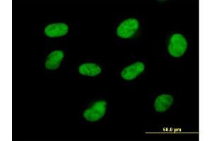 Immunofluorescence of purified MaxPab antibody to CDK7 on HeLa cell. (CDK7 antibody  (AA 1-346))