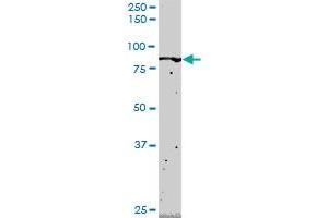 FLI1 monoclonal antibody (M02), clone 2G8. (FLI1 antibody  (AA 1-452))