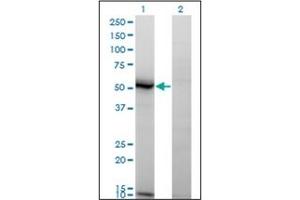 Western Blotting (WB) image for anti-N-Acylsphingosine Amidohydrolase (Acid Ceramidase) 1 (ASAH1) (AA 25-125) antibody (ABIN782337) (ASAH1 antibody  (AA 25-125))