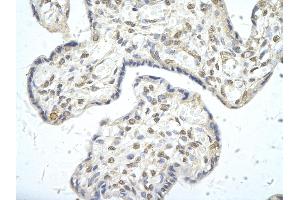 Rabbit Anti-PPARD antibody        Paraffin Embedded Tissue:  Human Placenta cell   Cellular Data:  Epithelial cells of renal tubule  Antibody Concentration:   4. (PPARD antibody  (C-Term))