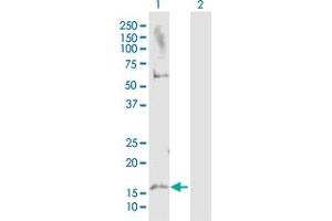 Western Blot analysis of MAP1LC3A expression in transfected 293T cell line by MAP1LC3A MaxPab polyclonal antibody. (MAP1LC3A antibody  (AA 1-121))