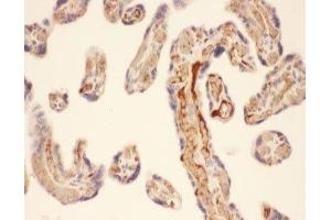 IHC-P: Chymase antibody testing of human placenta tissue
