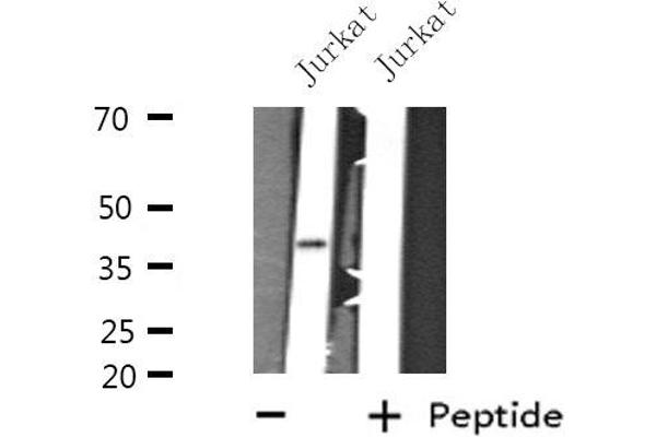 GTF3A antibody  (N-Term)