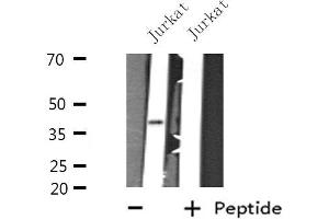 Western blot analysis of extracts from Jurkat cells, using GTF3A antibody. (GTF3A antibody  (N-Term))