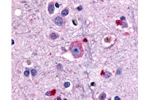 Anti-GRM1 / MGLUR1 antibody IHC of human brain, neurons and glia. (Metabotropic Glutamate Receptor 1 antibody  (N-Term))