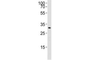Western blot analysis of lysate from rat liver using Cebpb antibody. (CEBPB antibody  (AA 99-131))