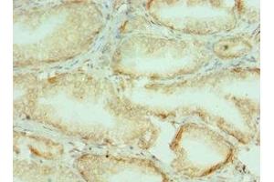 Immunohistochemistry of paraffin-embedded human prostate tissue using ABIN7148221 at dilution of 1:100 (COL1A1 antibody  (AA 521-680))