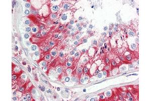Anti-LHCGR / LHR / LH Receptor antibody IHC staining of human testis. (LHCGR antibody  (AA 622-699))