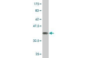 Western Blot detection against Immunogen (37. (NCOA4 antibody  (AA 505-614))