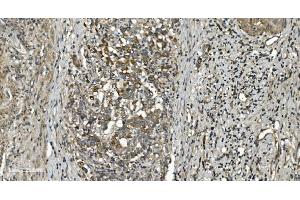 IHC analysis of RGS6 using anti-RGS6 antibody (ABIN7602326). (RGS6 antibody  (AA 7-357))