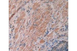 DAB staining on IHC-P; Samples: Human Prostate Gland Tissue (IL12A antibody  (AA 23-219))