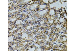 Immunohistochemistry of paraffin-embedded Mouse stomach using TRMT2A Polyclonal Antibody at dilution of 1:100 (40x lens).