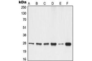 Western blot analysis of 14-3-3 gamma expression in A549 (A), A431 (B), K562 (C), NIH3T3 (D), PC12 (E), rat liver (F) whole cell lysates. (14-3-3 gamma antibody  (Center))