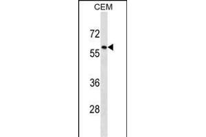 TRIM58 Antibody (C-term) (ABIN1537364 and ABIN2850371) western blot analysis in CEM cell line lysates (35 μg/lane). (TRIM58 antibody  (C-Term))