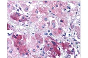 Human Adrenal: Formalin-Fixed, Paraffin-Embedded (FFPE) (TNIP3 antibody  (C-Term))