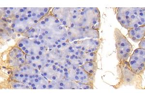 Detection of PIIINP in Mouse Pancreas Tissue using Polyclonal Antibody to Procollagen III N-Terminal Propeptide (PIIINP) (PIIINP antibody  (AA 24-154))