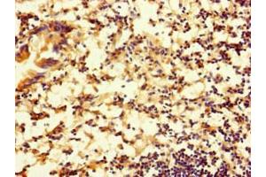 Immunohistochemistry of paraffin-embedded human appendix tissue using ABIN7167753 at dilution of 1:100 (RTN4IP1 antibody  (AA 41-396))