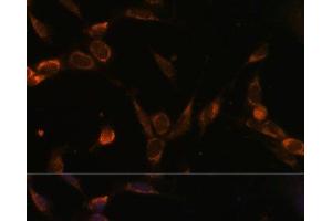 Immunofluorescence analysis of NIH-3T3 cells using USP30 Polyclonal Antibody at dilution of 1:100 (40x lens). (Usp30 antibody)