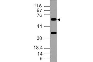 Image no. 1 for anti-Forkhead Box O1 (FOXO1) antibody (ABIN5026987) (FOXO1 antibody)
